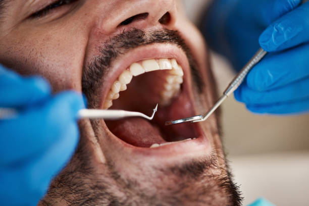 Best Emergency Treatment for Toothache in Seagraves, TX